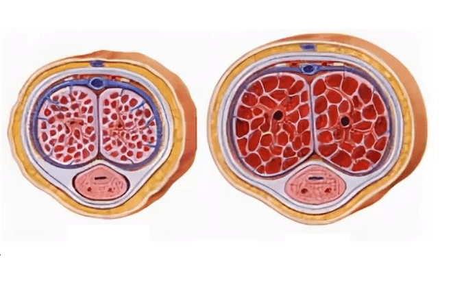 lipofillings dzimumlocekļa paplašināšanai